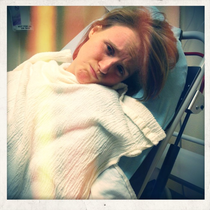 LA meets Kidney Stone